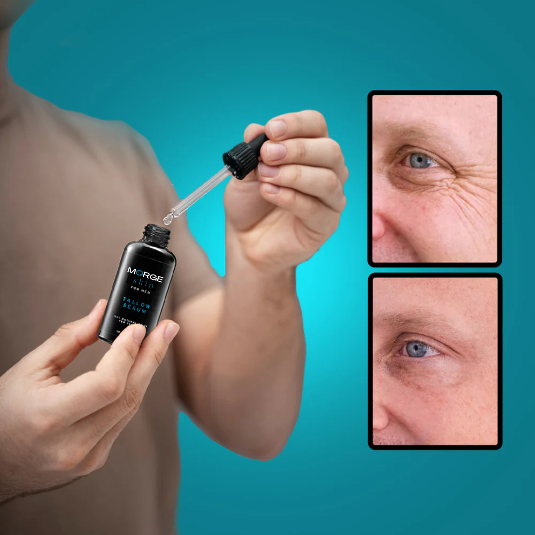 Morge™ Anti-Wrinkle Serum