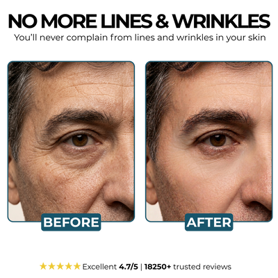 Morge™ Anti-Wrinkle Balm