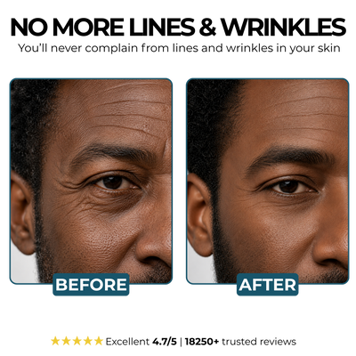 Morge™ Anti-Wrinkle Balm - Black Edition