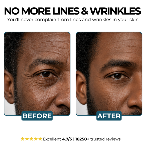Morge™ Anti-Wrinkle Balm - Black Edition