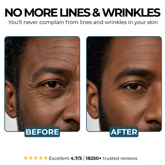 Morge™ Anti-Wrinkle Balm - Black Edition