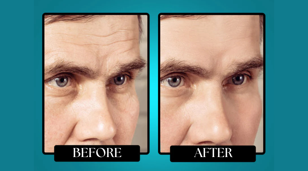 Morge™ Anti-Wrinkle Balm